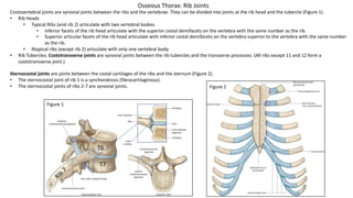 Osseous Thorax: Rib Joints
Costovertebral joints are synovial joints between the ribs and the vertebrae. They can be divided into joints at the rib head and the tubercle (Figure 1).
• Rib Heads
• Typical Ribs (and rib 2) articulate with two vertebral bodies
• Inferior facets of the rib head articulate with the superior costal demifacets on the vertebra with the same number as the rib.
• Superior articular facets of the rib head articulate with inferior costal demifacets on the vertebra superior to the vertebra with the same number
as the rib.
• Atypical ribs (except rib 2) articulate with only one vertebral body.
• Rib Tubercles: Costotransverse joints are synovial joints between the rib tubercles and the transverse processes. (All ribs except 11 and 12 form a
costotransverse joint.)
Sternocostal joints are joints between the costal cartilages of the ribs and the sternum (Figure 2).
• The sternocostal joint of rib 1 is a synchondrosis (fibrocartilaginous).
• The sternocostal joints of ribs 2-7 are synovial joints.
Rib
7
T6
T7
Figure 1
Figure 2
 