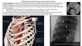 Coarctation
of Aorta
CLNICAL ANATOMY: The internal thoracic artery has branches that anastomose with branches of the aorta. Blood flowing
through this collateral circulation can be important when blood flow through the aorta is reduced, such as occurs in
congenital coarctation of the aorta and in acquired aortic stenosis. To bypass the area blocked, blood can take the following
alternative pathways:
Subclavian a à internal thoracic a à superior epigastric a à inferior epigastric a- à external iliac artery
Subclavian a à anterior intercostal a à anastomosis à posterior intercostal a à aorta
In the case of extra blood flow occurring within the intercostal arteries, the intercostal vessels can hypertrophy and cause
anatomical changes in the ribs, which can be seen as “rib notching” on CXR (see bottom right image).
Collateral Circulation Through Internal Thoracic Artery
https://3d4medic.al/5Bv15kRk
 