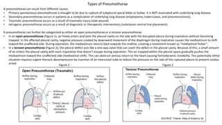 A pneumothorax can result from different causes.
• Primary spontaneous pneumothorax is thought to be due to rupture of subpleural apical blebs or bullae. It is NOT associated with underlying lung disease.
• Secondary pneumothorax occurs in patients as a complication of underlying lung disease (emphysema, tuberculosis, and pneumoconiosis).
• Traumatic pneumothorax occurs as a result of traumatic injury (stab wound).
• Iatrogenic pneumothorax occurs as a result of diagnostic or therapeutic interventions (subclavian central line placement).
A pneumothorax can further be categorized as either an open pneumothorax or a tension pneumothorax.
• In an open pneumothorax (Figure 1), air freely enters and exits the pleural cavity on the side with the disrupted pleura during inspiration without becoming
trapped. In the affected pleural cavity, negative pressure created by downward movement of the diaphragm during inspiration causes the mediastinum to shift
toward the unaffected side. During expiration, the mediastinum returns back towards the midline, creating a movement known as “mediastinal flutter”.
• In a tension pneumothorax (Figure 2), the pleural defect acts like a one-way valve that can cover the defect in the pleural cavity. Because of this, a small amount
of air enters the pleural cavity with each inspiration that doesn’t escape during expiration. This air trapped within the pleural space gradually pushes the
mediastinum toward the unaffected side (mediastinal shift). This can obstruct venous return to the heart causing hemodynamic instability. This potentially lethal
situation requires urgent thoracic decompression by insertion of an intercostal tube to reduce the pressure on the side of the ruptured pleura to prevent cardiac
arrest. Figure 1 Figure 2
Types of Pneumothorax
 