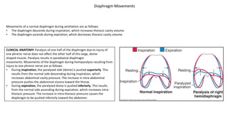 CLINICAL ANATOMY: Paralysis of one half of the diaphragm due to injury of
one phrenic nerve does not affect the other half of this large, dome-
shaped muscle. Paralysis results in paradoxical diaphragm
movements. Movements of the diaphragm during hemiparalysis resulting from
injury to one phrenic nerve are as follows.
• During inspiration, the paralyzed side (dome) is pushed superiorly. This
results from the normal side descending during inspiration, which
increases abdominal cavity pressure. The increase in intra-abdominal
pressure pushes the abdominal viscera toward the thorax.
• During expiration, the paralyzed dome is pushed inferiorly. This results
from the normal side ascending during expiration, which increases intra-
thoracic pressure. The increase in intra-thoracic pressure causes the
diaphragm to be pushed inferiorly toward the abdomen.
Movements of a normal diaphragm during ventilation are as follows:
• The diaphragm descends during inspiration, which increases thoracic cavity volume.
• The diaphragm ascends during expiration, which decreases thoracic cavity volume.
Diaphragm Movements
 