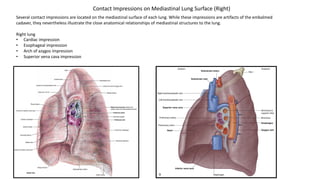 Several contact impressions are located on the mediastinal surface of each lung. While these impressions are artifacts of the embalmed
cadaver, they nevertheless illustrate the close anatomical relationships of mediastinal structures to the lung.
Right lung
• Cardiac impression
• Esophageal impression
• Arch of azygos impression
• Superior vena cava impression
Contact Impressions on Mediastinal Lung Surface (Right)
 