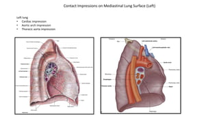Left lung
• Cardiac impression
• Aortic arch impression
• Thoracic aorta impression
Contact Impressions on Mediastinal Lung Surface (Left)
 