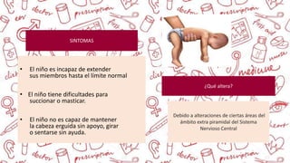 • El niño es incapaz de extender
sus miembros hasta el límite normal
• El niño tiene dificultades para
succionar o masticar.
• El niño no es capaz de mantener
la cabeza erguida sin apoyo, girar
o sentarse sin ayuda.
SINTOMAS
Debido a alteraciones de ciertas áreas del
ámbito extra piramidal del Sistema
Nervioso Central
¿Qué altera?
 