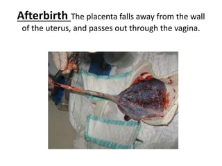 Afterbirth The placenta falls away from the wall
of the uterus, and passes out through the vagina.
 