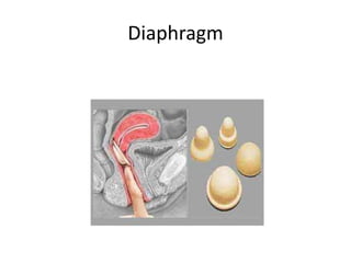 Diaphragm
 