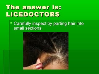 The answer is:The answer is:
LICEDOCTORSLICEDOCTORS
 Carefully inspect by parting hair intoCarefully inspect by parting hair into
small sectionssmall sections
 