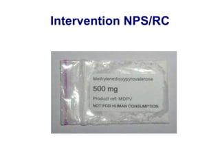 Intervention NPS/RC

 