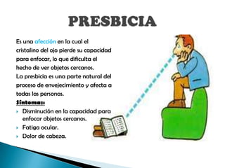 Es una afección en la cual el
cristalino del ojo pierde su capacidad
para enfocar, lo que dificulta el
hecho de ver objetos cercanos.
La presbicia es una parte natural del
proceso de envejecimiento y afecta a
todas las personas.
Síntomas:
 Disminución en la capacidad para
   enfocar objetos cercanos.
 Fatiga ocular.

 Dolor de cabeza.
 