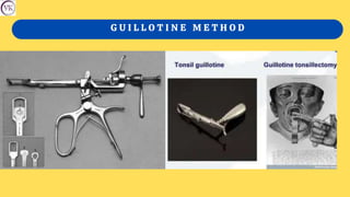 G U I L L O T I N E M E T H O D
 