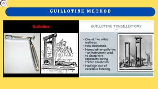 G U I L L O T I N E M E T H O D
 