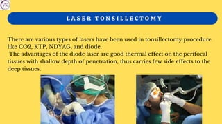 L A S E R T O N S I L L E C T O M Y
There are various types of lasers have been used in tonsillectomy procedure
like CO2, KTP, NDYAG, and diode.
The advantages of the diode laser are good thermal effect on the perifocal
tissues with shallow depth of penetration, thus carries few side effects to the
deep tissues.
 