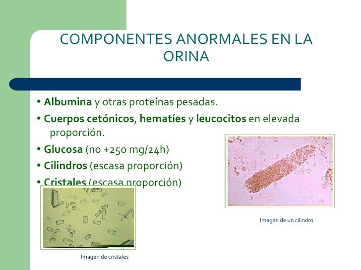 La orina y sus métodos de extracción
