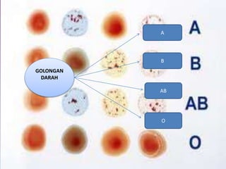 A
AB
B
O
GOLONGAN
DARAH
 