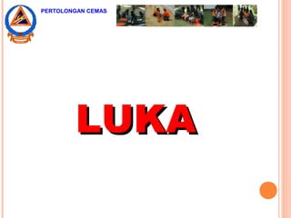 LUKALUKA
PERTOLONGAN CEMAS
 