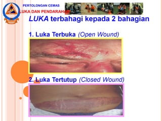 PERTOLONGAN CEMAS
LUKA DAN PENDARAHAN
 