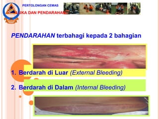 PENDARAHAN terbahagi kepada 2 bahagian
1. Berdarah di Luar (External Bleeding)
2. Berdarah di Dalam (Internal Bleeding)
PERTOLONGAN CEMAS
LUKA DAN PENDARAHAN
 