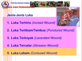 Jenis-Jenis Luka
1. Luka Terhiris (Incised Wound)
2. Luka Tertikam/Tembus (Punctured Wound)
3. Luka Terkoyak (Lacerated Wound)
4. Luka Tercalar (Abrasion Wound)
5. Luka Lebam (Contused Wound)
PERTOLONGAN CEMAS
LUKA DAN PENDARAHAN
 