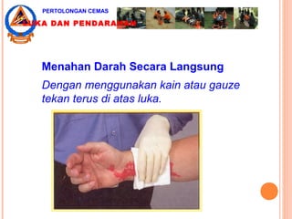 Menahan Darah Secara Langsung
Dengan menggunakan kain atau gauze
tekan terus di atas luka.
PERTOLONGAN CEMAS
LUKA DAN PENDARAHAN
 