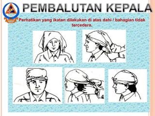 .
Perhatikan yang ikatan dilakukan di atas dahi / bahagian tidak
tercedera.
 