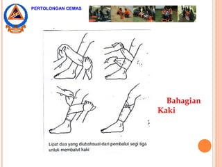 Bahagian
Kaki
PERTOLONGAN CEMAS
 