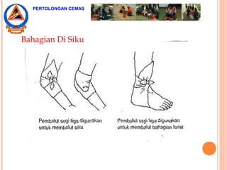 Bahagian Di Siku
PERTOLONGAN CEMAS
 