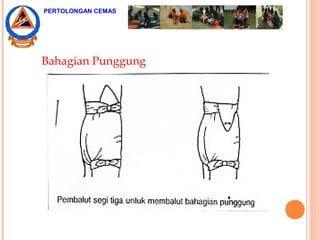 Bahagian Punggung
PERTOLONGAN CEMAS
 