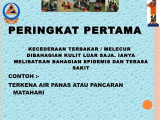 PERINGKAT PERTAMAPERINGKAT PERTAMA
KECEDERAAN TERBAKAR / MELECURKECEDERAAN TERBAKAR / MELECUR
DIBAHAGIAN KULIT LUAR SAJA. IANYADIBAHAGIAN KULIT LUAR SAJA. IANYA
MELIBATKAN BAHAGIAN EPIDEMIS DAN TERASAMELIBATKAN BAHAGIAN EPIDEMIS DAN TERASA
SAKITSAKIT
CONTOH :-
TERKENA AIR PANAS ATAU PANCARAN
MATAHARI
 