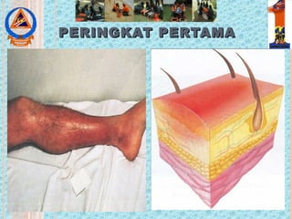 PERINGKAT PERTAMAPERINGKAT PERTAMA
 