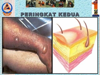 PERINGKAT KEDUAPERINGKAT KEDUA
 