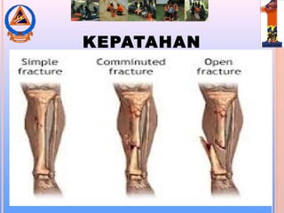 KEPATAHAN
 