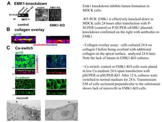 Emk1 knockdown inhibits lumen formation in MDCK cells: RT-PCR: EMK1 is effectively knocked down in MDCK cells 24 hours after transfection with P-SUPER (control) or P-SUPER-siEMK1 plasmid; knockdown confirmed on the right with antibodies to EMK1. Collagen overlay assay:  cells cultured 24 h on collagen I before being overlaid with additional collagen on the apical surface,  analyzed 24 h later. Note the lack of lumen in EMK1-KO cultures. Ca switch: control or EMK1-KO cells were plated in low Ca medium 24 h upon transfection with pSUPER or pSUPER-KO. After 12 h, cultures were switched to normal medium for 24 h. Transmission EM of cells sectioned perpendicular to the substratum shows lack of microvilli in EMK1-KO cells. 