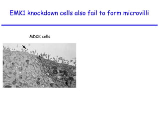 EMK1 knockdown cells also fail to form microvilli  MDCK cells EMK1 knockdown 