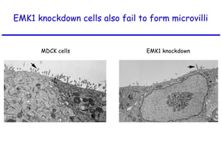EMK1 knockdown cells also fail to form microvilli  MDCK cells EMK1 knockdown 