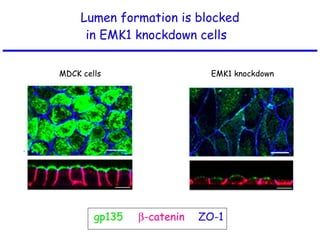 Lumen formation is blocked in EMK1 knockdown cells  gp135  -catenin ZO-1 MDCK cells EMK1 knockdown 