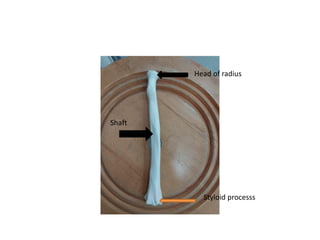 Head of radius
Shaft
Styloid processs