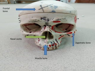 Frontal
bone
Maxilla bone
Nasal cavity
Zygomatic bone