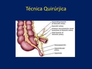 Técnica Quirúrjica
 