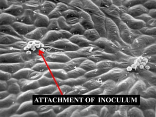 ATTACHMENT OF INOCULUM
 