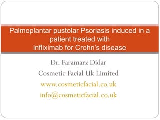 Dr. Faramarz Didar
Cosmetic Facial Uk Limited
www.cosmeticfacial.co.uk
info@cosmeticfacial.co.uk
Palmoplantar pustolar Psoriasis induced in a
patient treated with
infliximab for Crohn’s disease
 