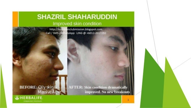 herbalife skin care for acne