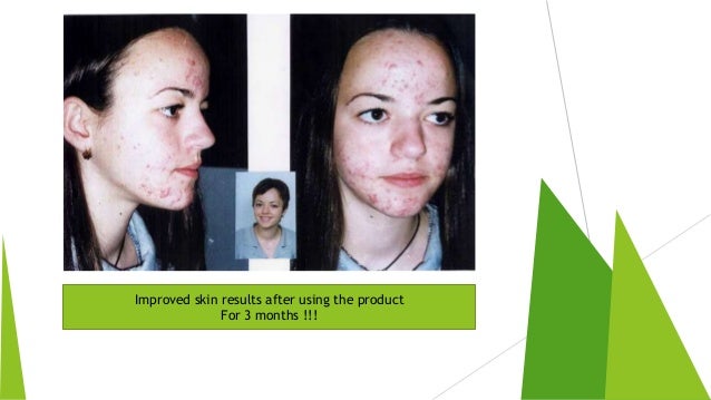 SKIN CARE PRODUCTS OF HERBALIFE