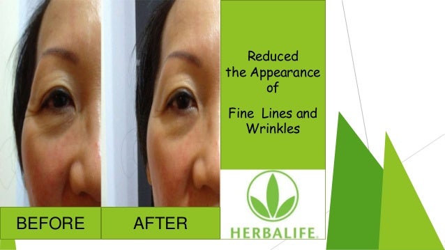 herbalife for skin problems