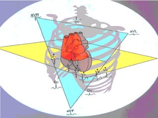 Powerpoint sobre eletrocardiografia