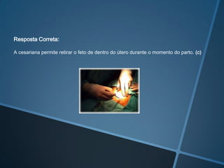 Resposta Correta:

A cesariana permite retirar o feto de dentro do útero durante o momento do parto. (c)
 