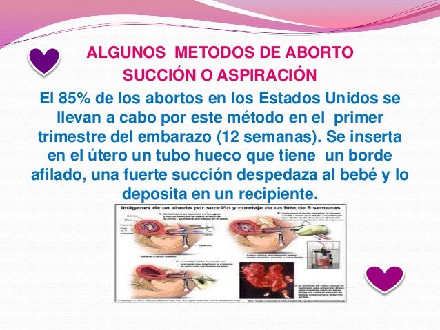 Duele una parte de la cabeza del cuello y la espalda