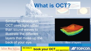 What is OCT? 
Similar to ultrasound, 
OCT uses light rather 
than sound waves to 
illustrate the different 
layers that make up the 
back of your eye. View of layers 
book your OCT Ask today to 
scan appointment 
 