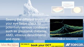 Seeing the different layers of 
your eye helps check for 
potentially serious conditions 
such as glaucoma, diabetes, 
AMD, vitreous detachments 
and more. Retinal detachment 
book your OCT Ask today to 
scan appointment 
 