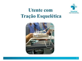 Utente com
Tração Esquelética




                     11
 