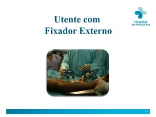 Utente com
Fixador Externo




                  17
 
