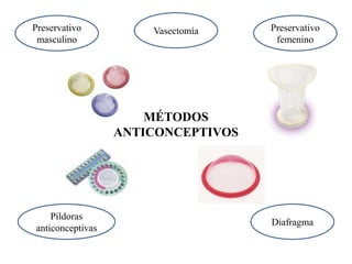 Preservativo          Vasectomía    Preservativo
 masculino                           femenino




                      MÉTODOS
                  ANTICONCEPTIVOS




    Píldoras
                                    Diafragma
anticonceptivas
 